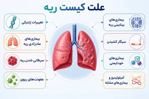 علت کیست ریه