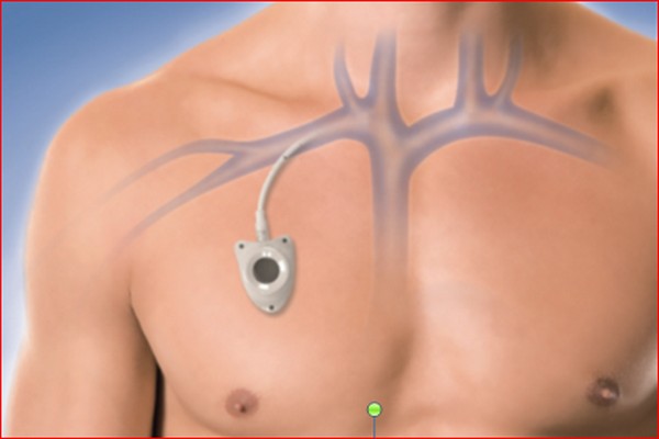 محل قرار گیری پورت