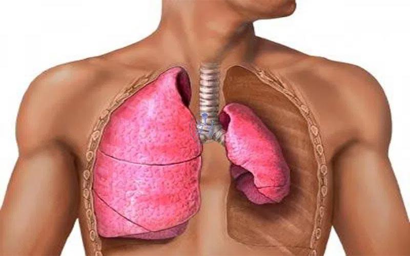 بیماری آتلکتازی چیست؟ بررسی علائم، علت و روش تشخیص